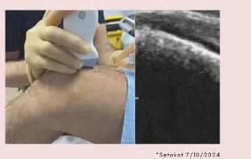 Imbasan ultrasound pada lutut pesakit di Klinik Dr Mohd Ali Jengka