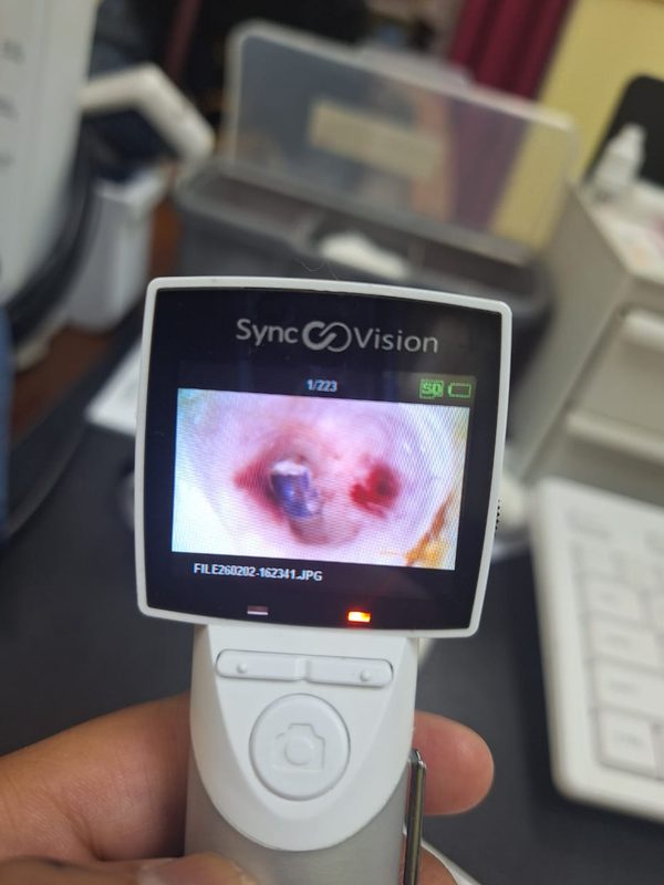 Mesin video otoscope klinik